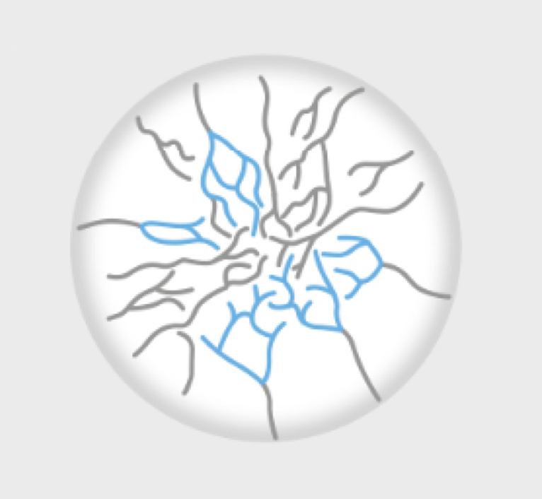 정상 신경 네트워크
